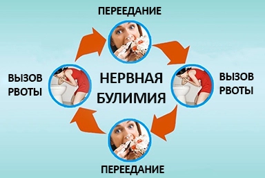 Лечение булимии в Каменке-Днепровской